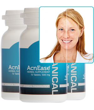 Ancien Traitement Acne Leger 100% botanique contre l acne Ancien Traitement Acne Leger 100% botanique contre l acne